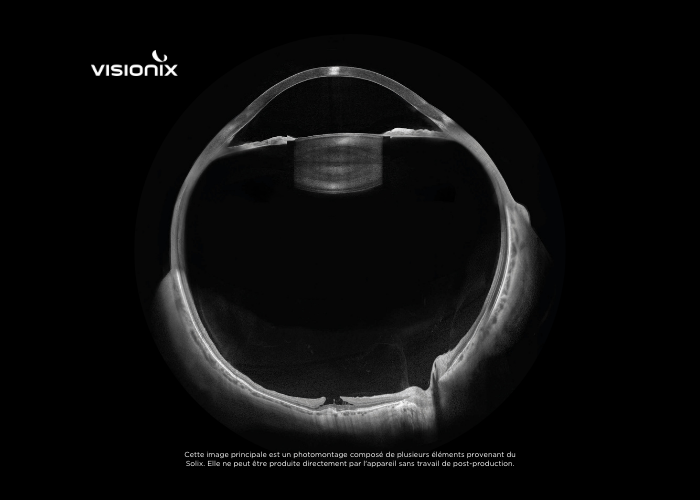 Quel est le meilleur équipement pour le diagnostic et le suivi des pathologies oculaires ?
